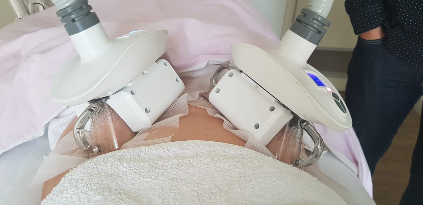 cryolipolyse marseille 8ème - mincir par le froid
