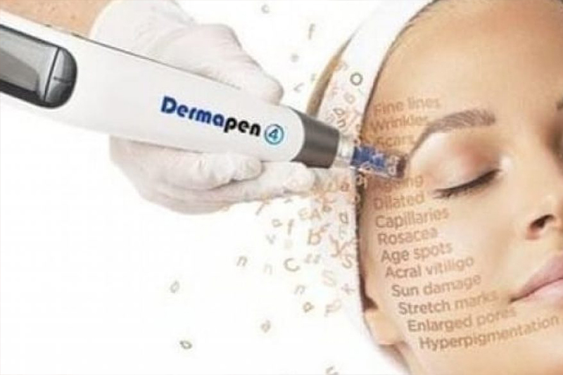 microneedling - dermapen - cosmoligne