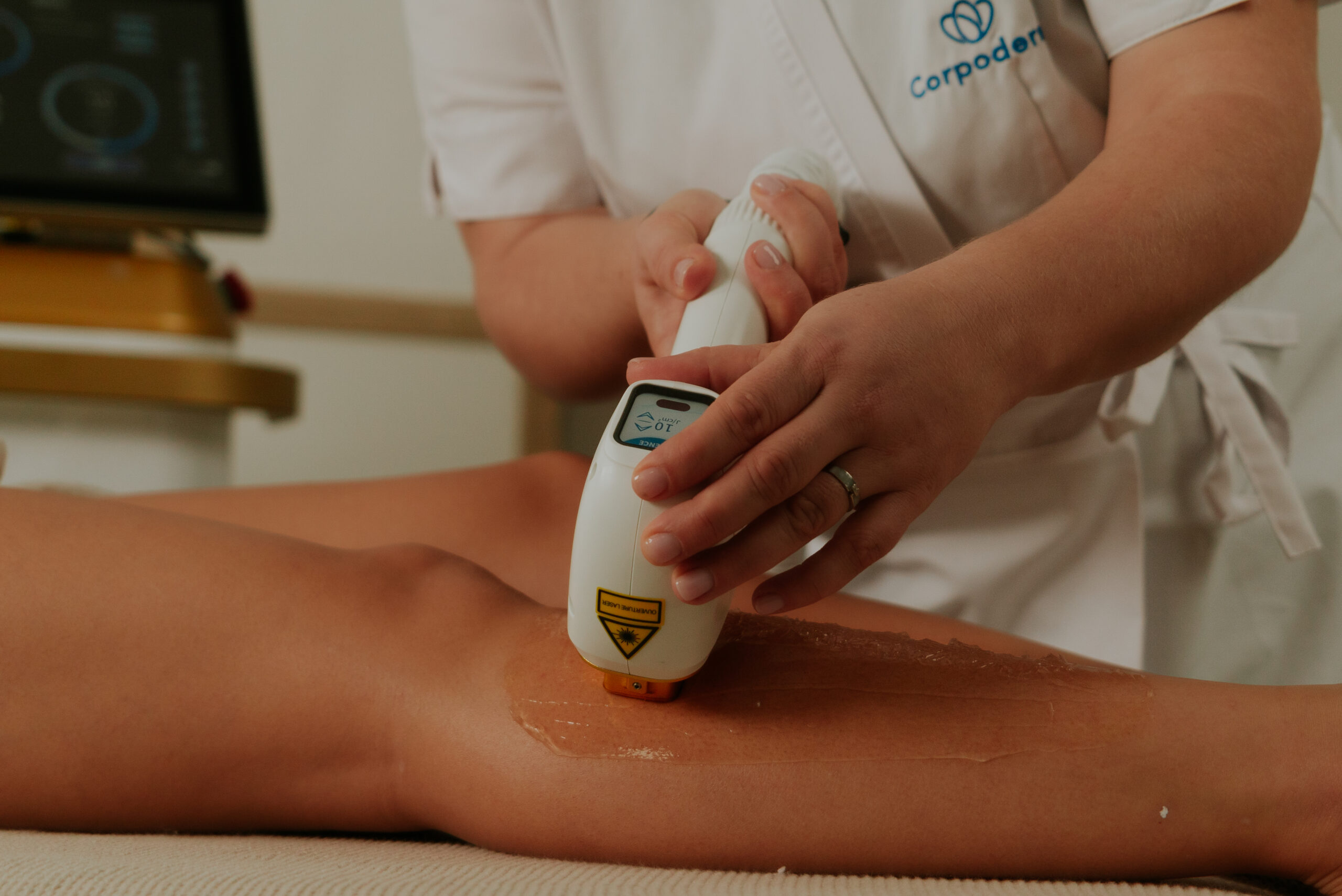 epilation définitive jambes au laser -LASER COSMOLIGNE